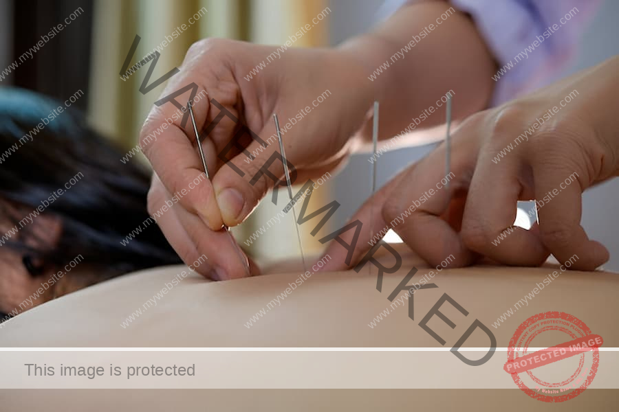 Acupuncture For Weight Loss: Can It Really Work